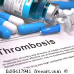 diagnosis-thrombosis-medical-concept_fa36417941